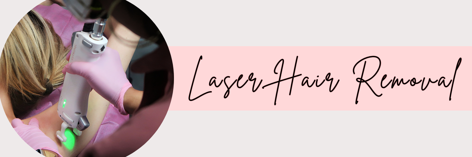 Laser Hair Removal for PCOS