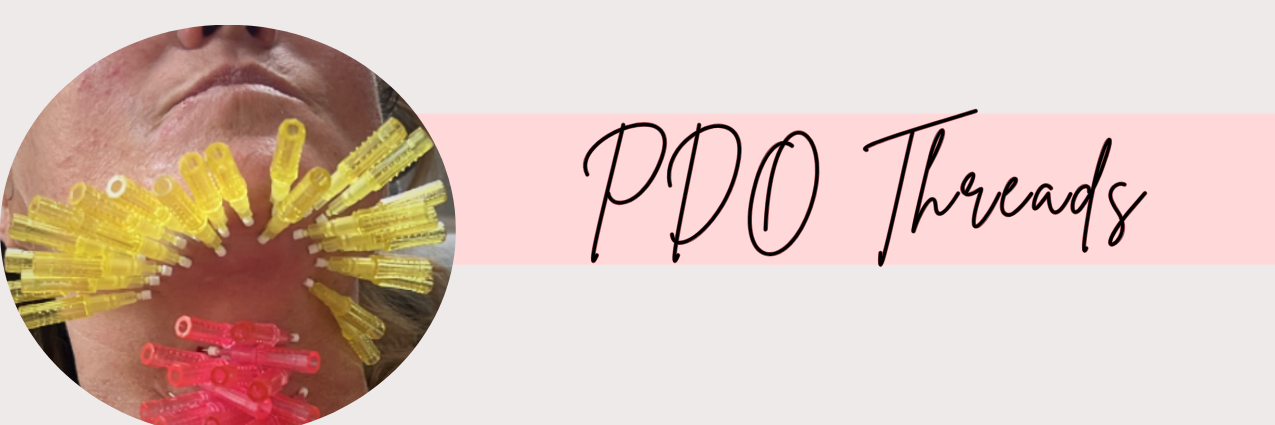 PDO Thread Lift at Taft Aesthetics in Wilson NC