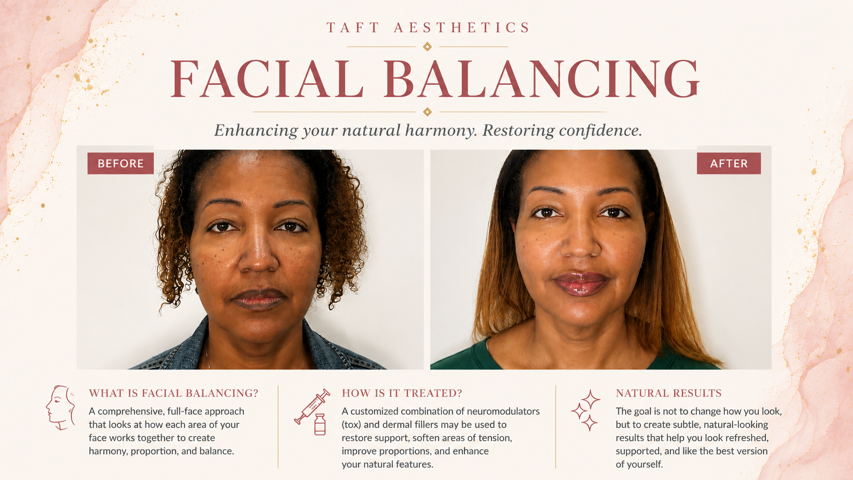 Facial Balancing Before and After at Taft Aesthetics LLC in Wilson NC
